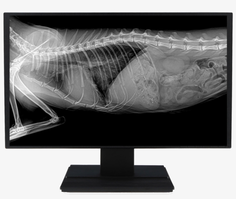 By Mano Medical - Led-backlit Lcd Display, transparent png download