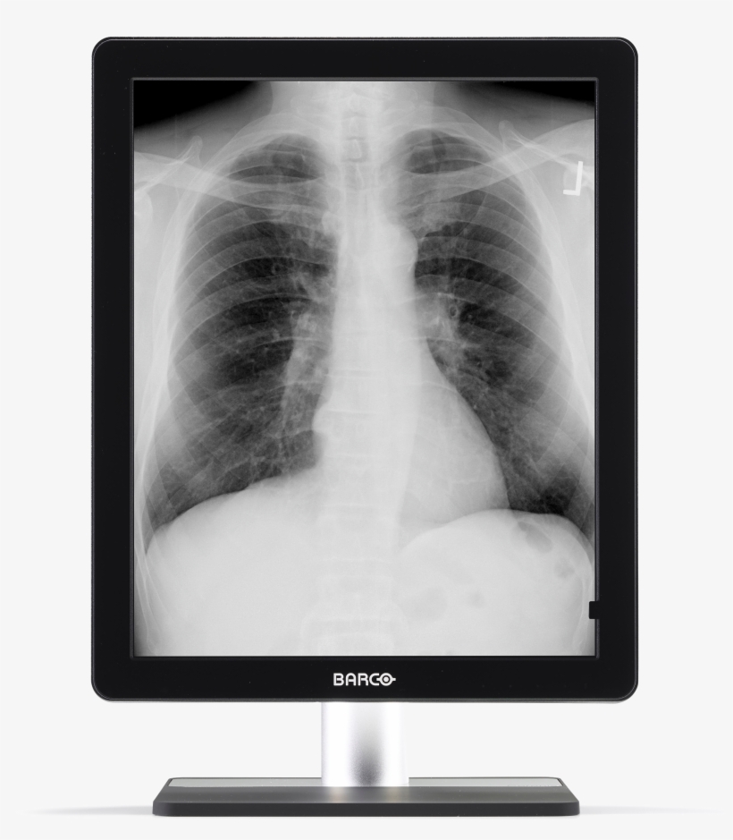 High Return On Investment Barco's Led Backlight Are - Mdcg 5221, transparent png download