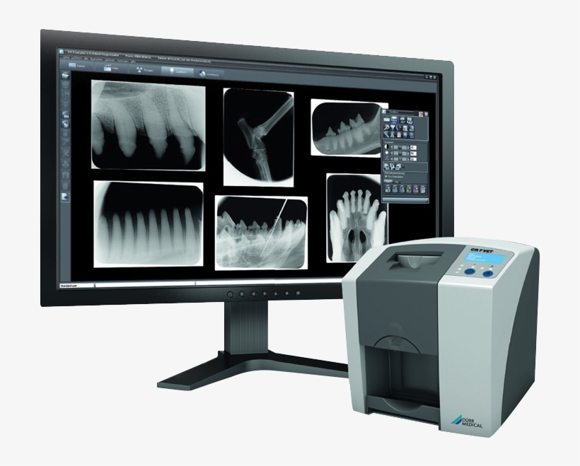 Im3 Cr7 Vet Dental Xray System - Cr7 Dental X Ray, transparent png download