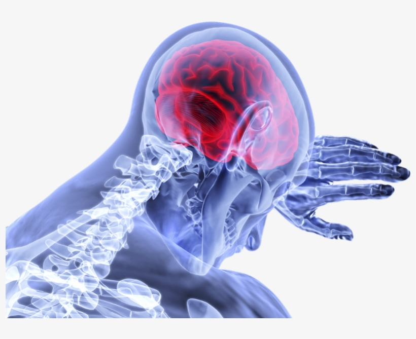 Brain Stroke Png, transparent png download