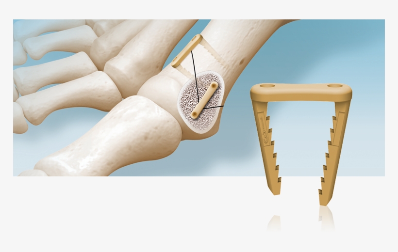 Os2 C Staple - Chair, transparent png download