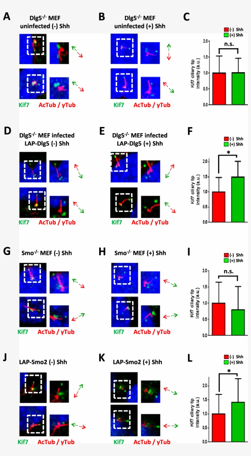 Shh-induced Accumulation Of Kif7 At The Tip Of The - Dlg5, transparent png download