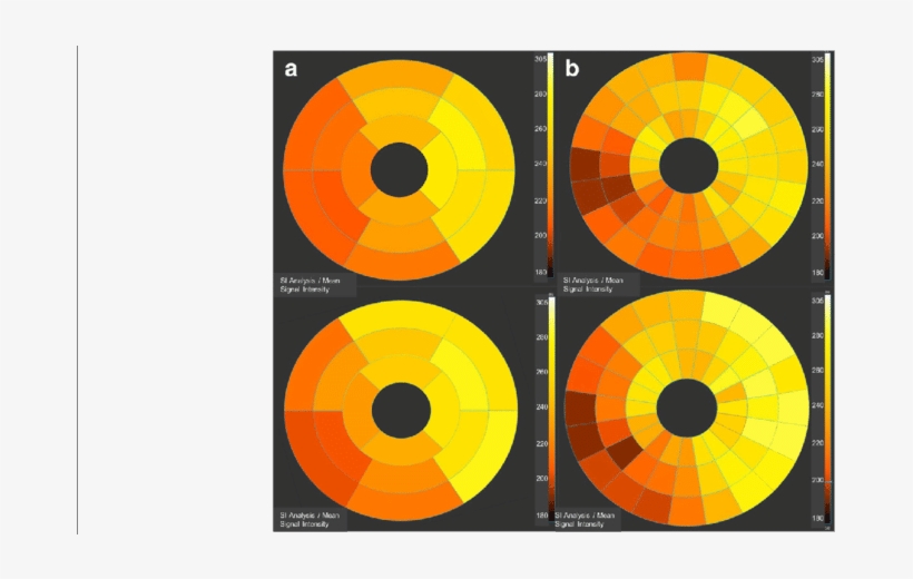 Bulls Eye Graphs Representing The Mean Signal Intensity - Circle, transparent png download