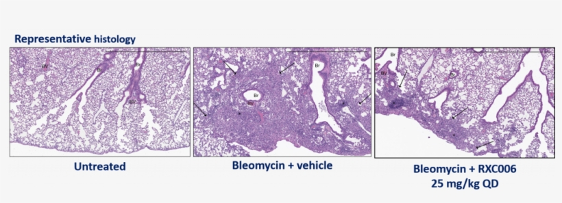 Image Representative Of Group Mean Ashcroft Scores - Blue-footed Booby, transparent png download