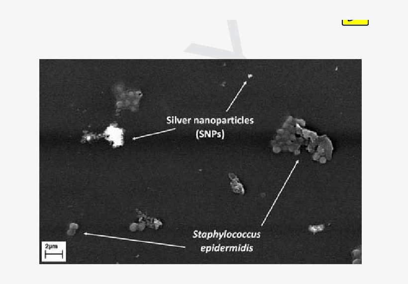 Sem Images Of The Lens Surface - Photo Caption, transparent png download