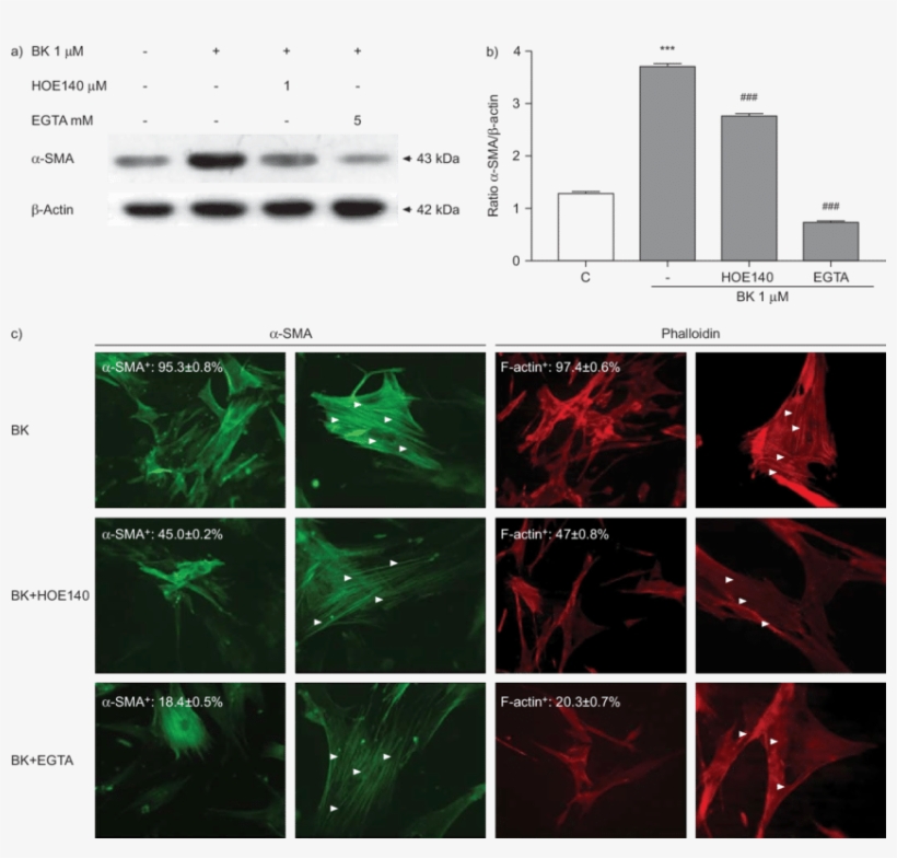 Effect Of Bradykinin On Myofibroblast Differentiation - F Actin A Sma, transparent png download