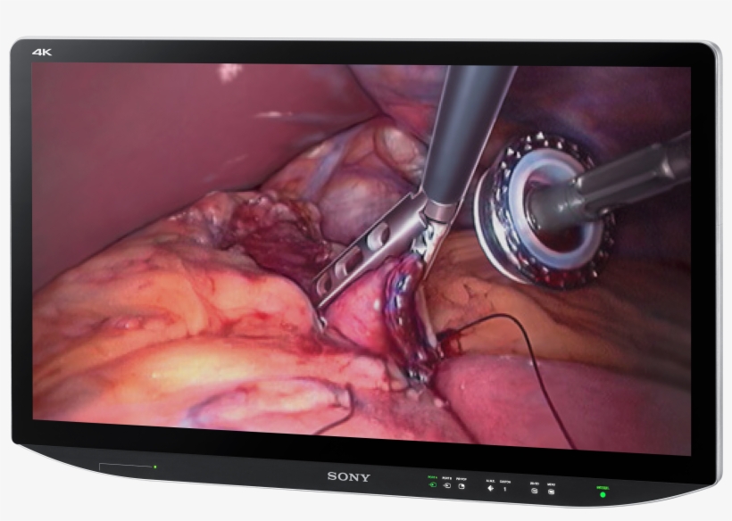 Sony Medical Monitors, transparent png download