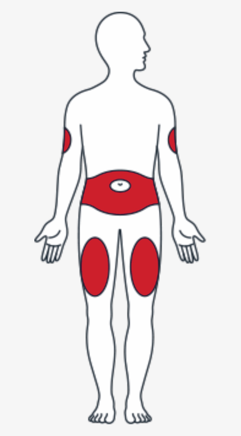 Front Side Appropriate Injection Sites - Humalog Mix 25 Pen 100 Ui Ml Kwikpen, transparent png download