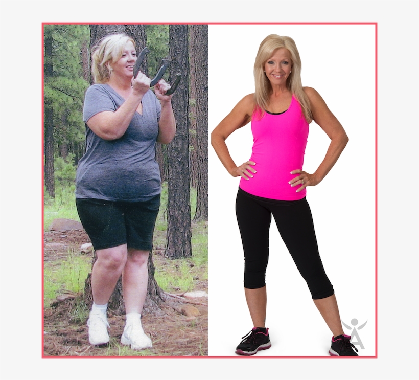 , Mesa, Az - 140 Lb Weight Loss, transparent png download