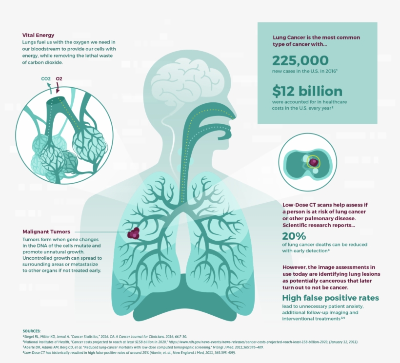 The Prize - 2017 Data Science Bowl, transparent png download