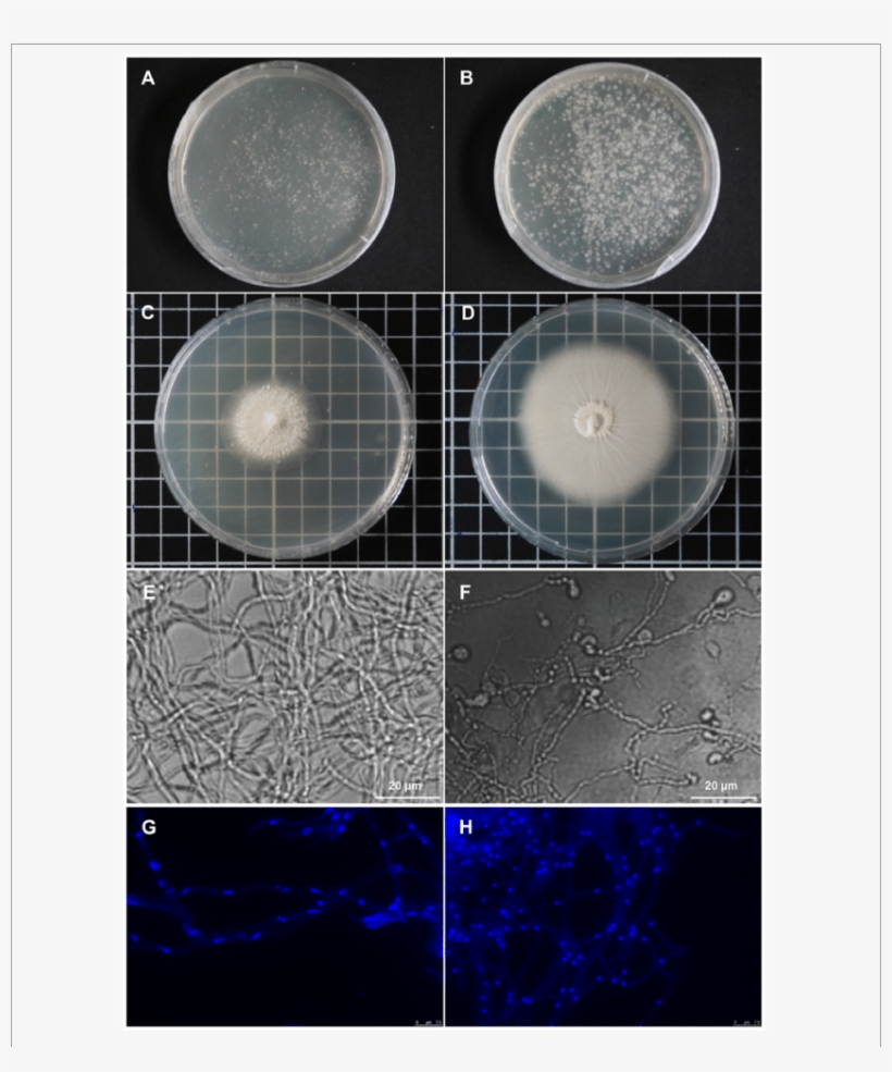 Piriformospora Indica Cultures Grown From Single Protoplasts - Laccaria Bicolor Petri Dishes, transparent png download
