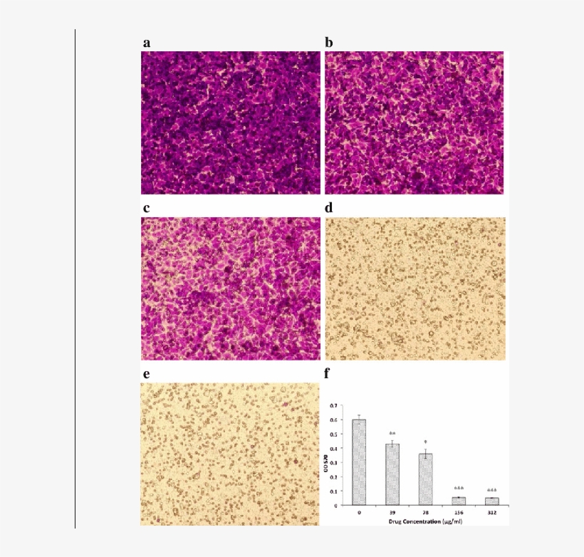 Effect Of Oridonin On Huvec Migration - Glitter, transparent png download