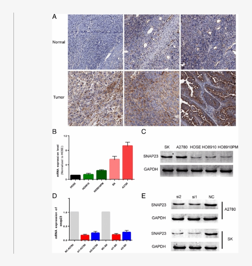 Snap23 Is Highly Expressed In Oc Tissues And Cells - Tile, transparent png download