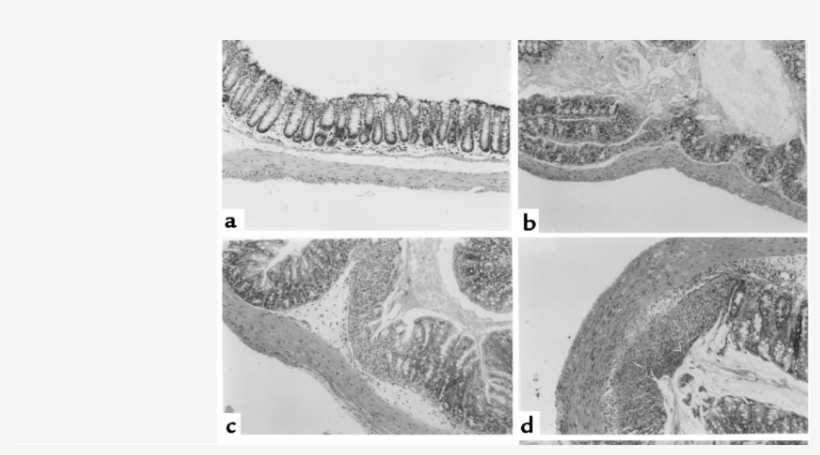 Photomicrographs Of The Proximal Colon Of Mice Treated - Monochrome, transparent png download