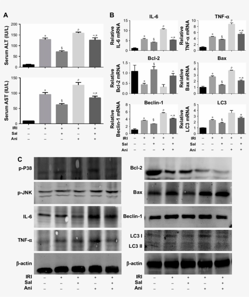 The Protective Effects Of Sal On Hepatic Iri Are Associated - Architecture, transparent png download
