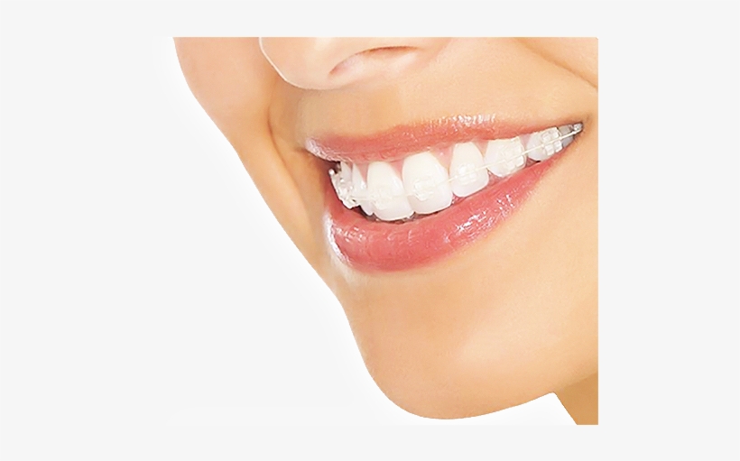 Planes Ortodoncia Desde $180 - Tongue, transparent png download