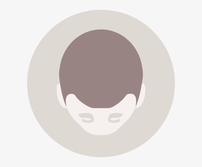 Men's Hair Loss - Circle, transparent png download