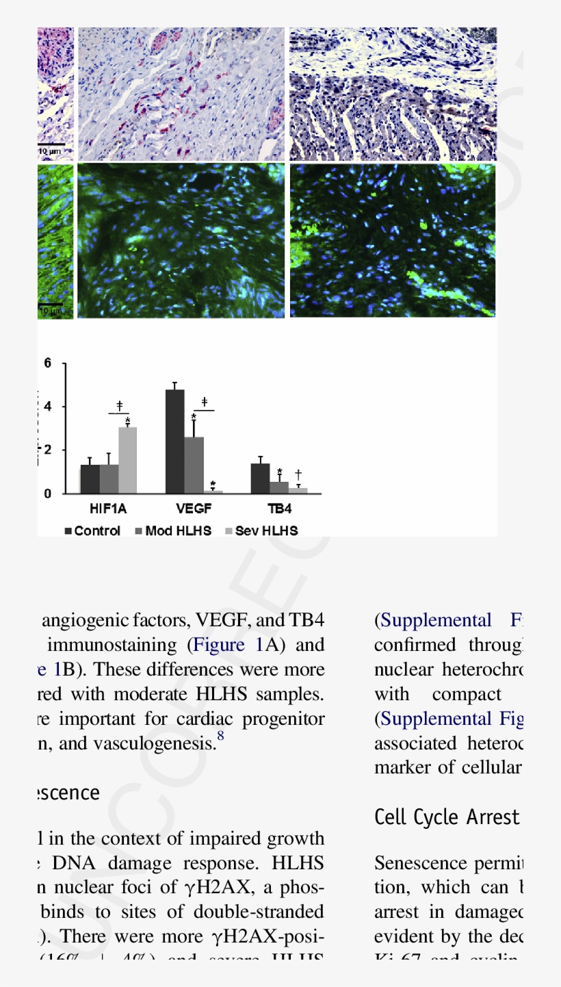 Hif-1a And Downstream Growth Factor Expression In Fetal - Architecture, transparent png download