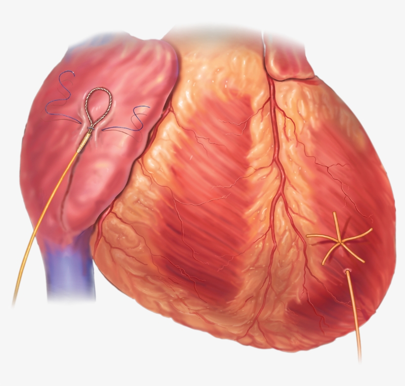 Pacing Wires - Tongue, transparent png download