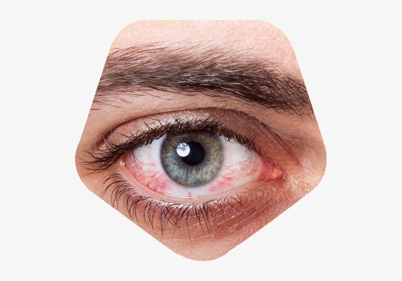 Dry Eyes - Daño A Los Ojos Por El Celular, transparent png download