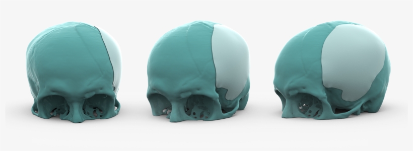 Baner Ovomax - Skull, transparent png download