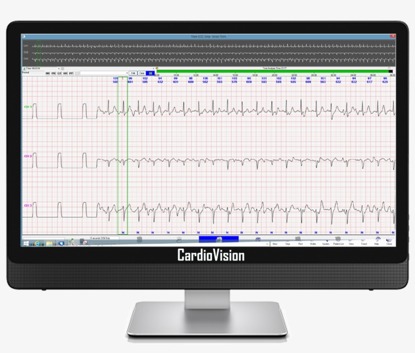 Enlarged Ecg Display - Computer Monitor, transparent png download