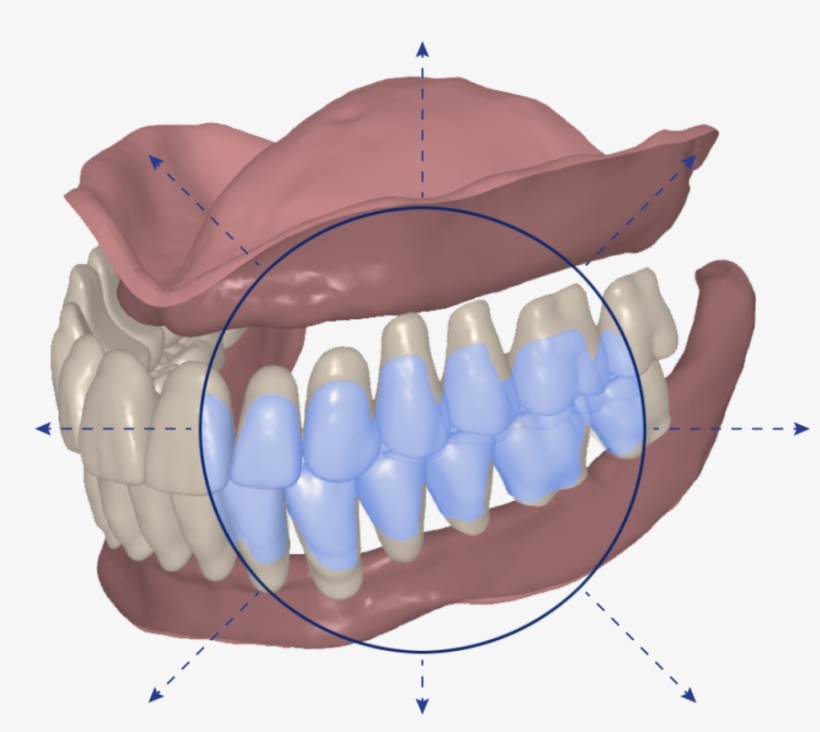 Avadent Digital Dental Solutions Has Always Provided, transparent png download
