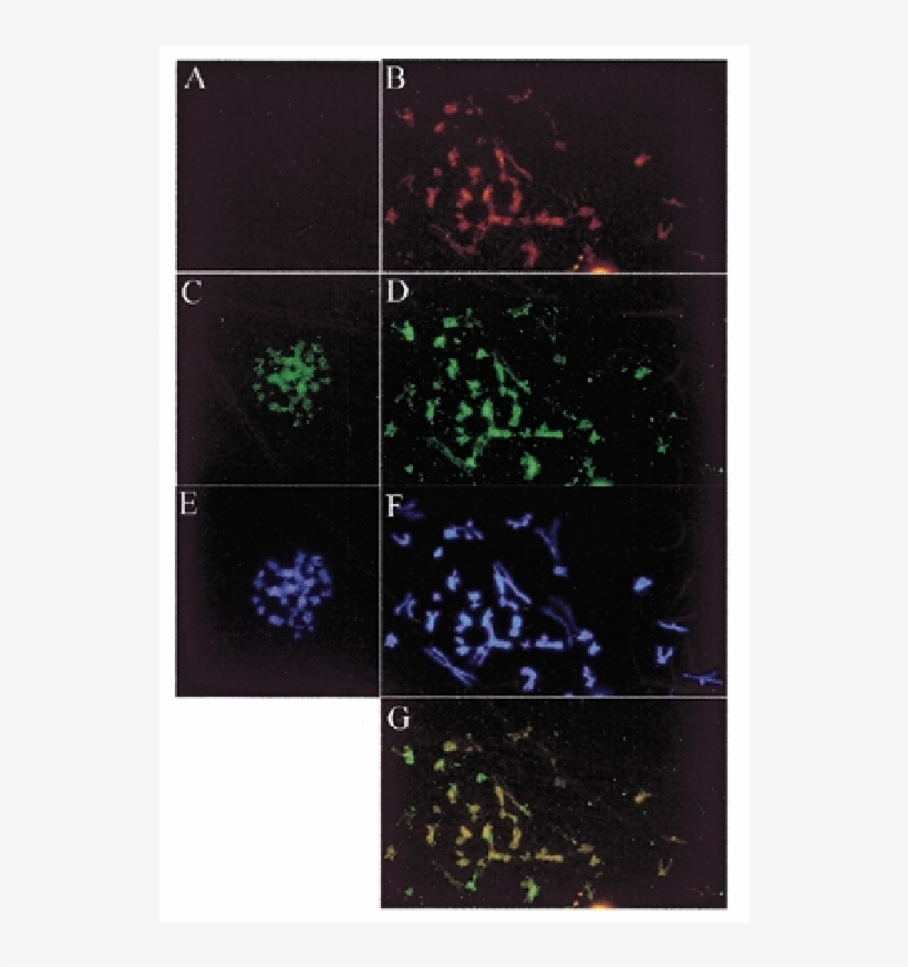 Localization Of Ebp2 And Ebna1 On Mitotic Chromosomes - Tile, transparent png download