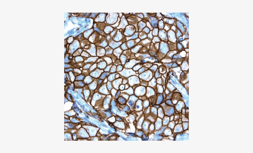 Pathway® Her-2/neu Rabbit Monoclonal Primary Antibody - Stained Glass, transparent png download