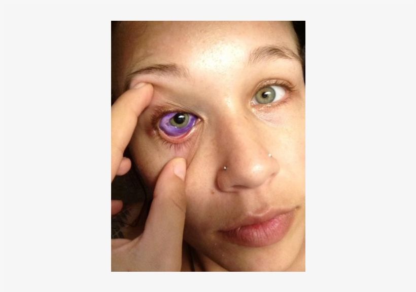 Tatuagem No Olho Acaba Com Lágrimas Roxas - Eyeball Tattooed, transparent png download