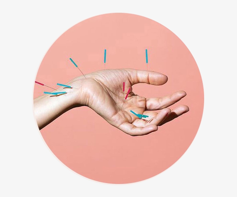 Acupunture - Akupunktur Can Acıtır Mı, transparent png download