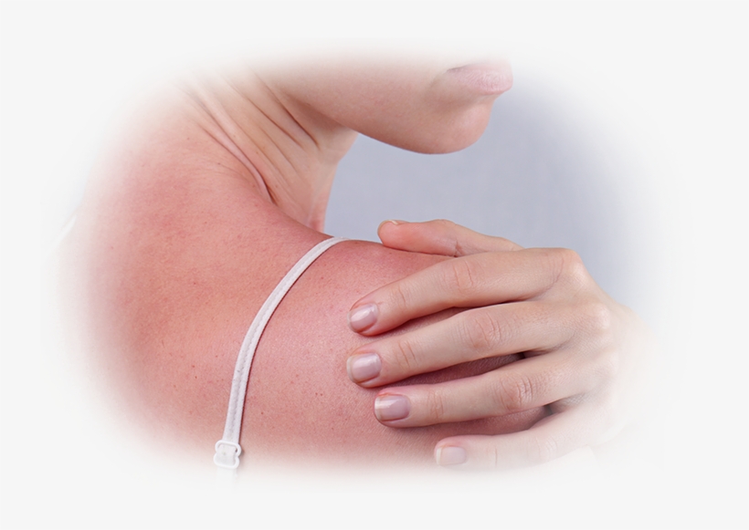 Sun Damaged Skin - Nature Republic, transparent png download