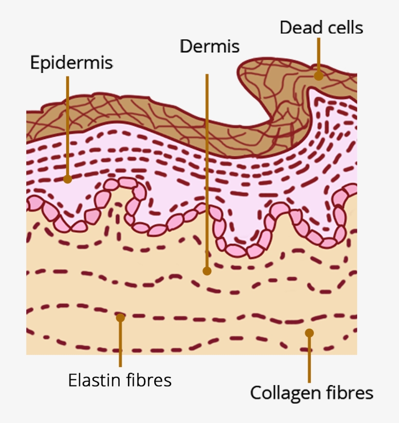 What Causes - Bruises - Diagram, transparent png download