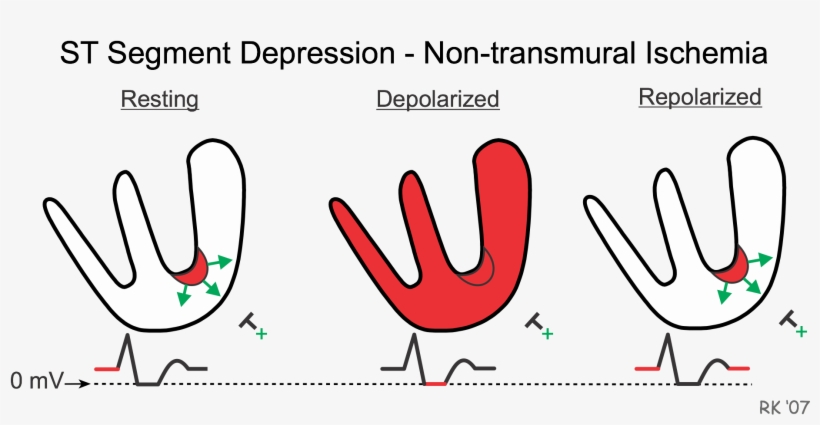 Cad012 St Depression Model - St Segment Elevation, transparent png download