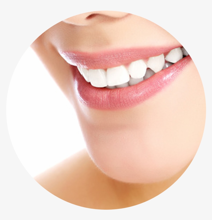 Crowns Are Called Indirect Restorations, Because The - White Teeth With Face Png, transparent png download