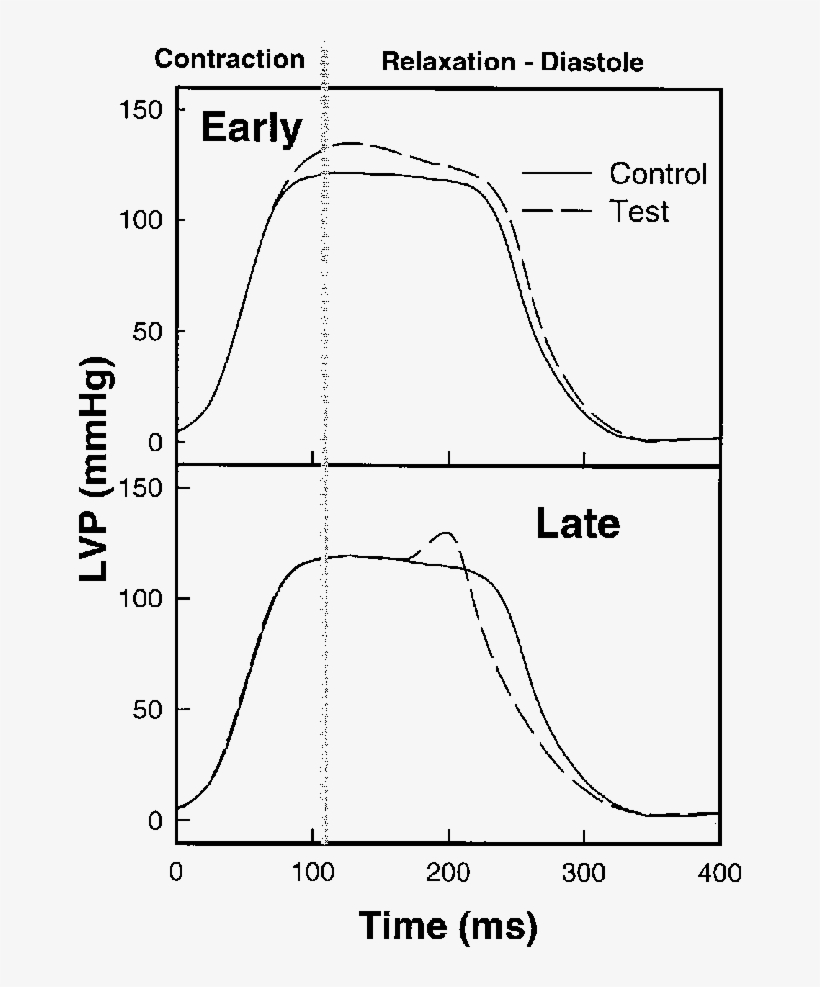 The Control Heartbeat Is Displayed As A Solid Line - Diagram, transparent png download