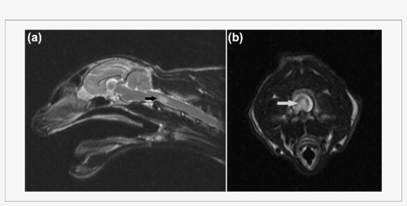 Sagittal T2-weighted (t2w) Image Of The Head And Neck - Radiology, transparent png download