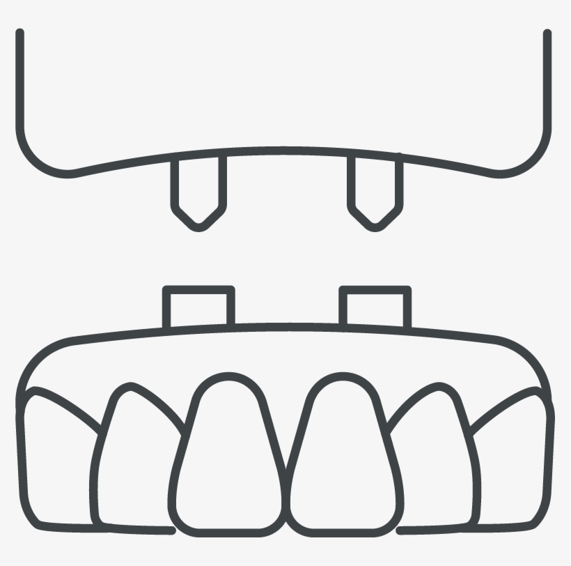 Replacing Missing Teeth Icon - Digital X Rays Dental Icon Free White, transparent png download