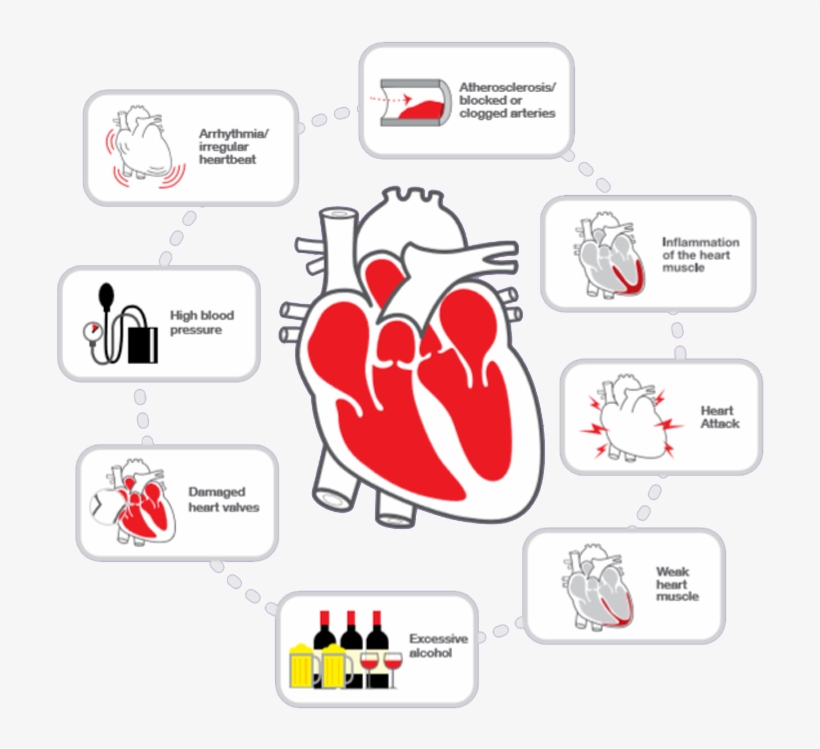 In Most Cases, Heart Failure Does Not Have A Single - Parallel, transparent png download