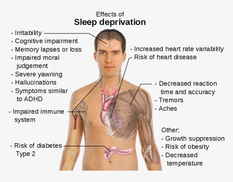 This Guide Gets At The Link Between Anxiety And Sleep - Organs In The Body Female, transparent png download