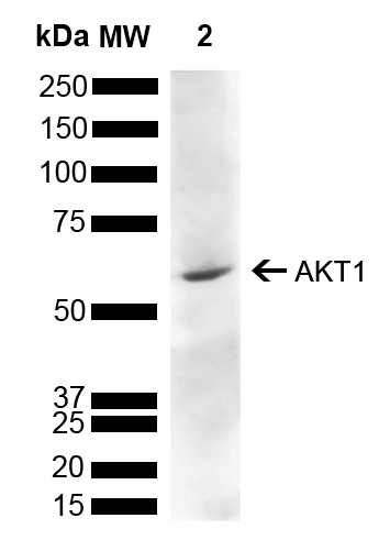 Spc-789 Akt1 Antibody Wb Rat Liver 1 - Antibody (500x500), Png Download