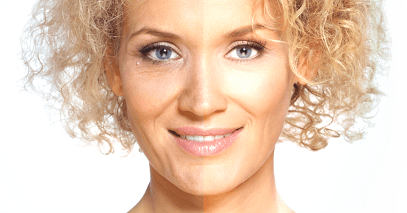 Get Rid Of Wrinkles - Brazilian Plastic Surgery (585x307), Png Download