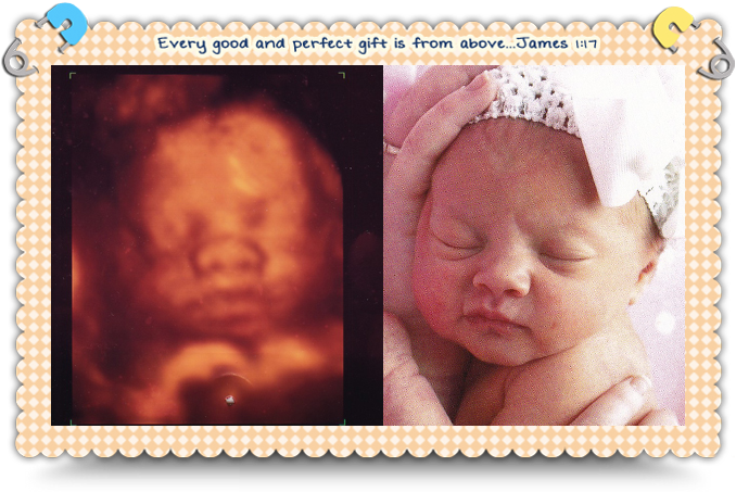 Baby Piper - Baby Face 4d Ultrasound (678x453), Png Download