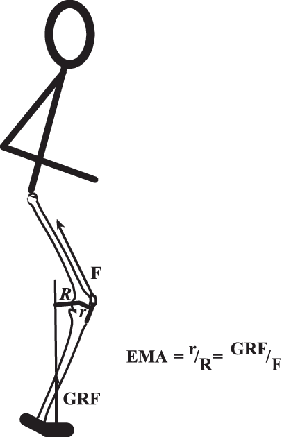 Limb Muscle Mechanical Advantage Is Defined As The - Mechanical Advantage (406x630), Png Download