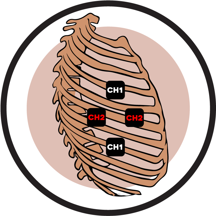 Rib Cage Electrode Pad Placement - Stimulation (764x768), Png Download