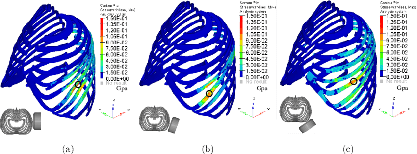Stress Distribution Of Ribcage In Impacts At Three - Diagram (850x315), Png Download