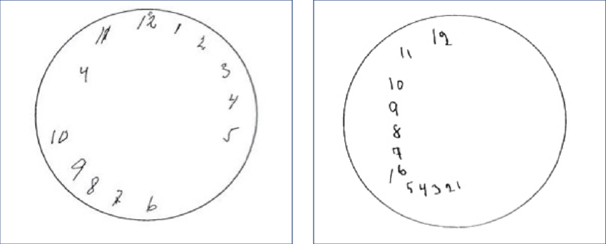 Resultado Del Dibujo De La Prueba Del Reloj - Figura De Un Reloj Png (850x343), Png Download