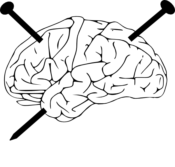 Small - Black And White Anatomical Brain (600x572), Png Download