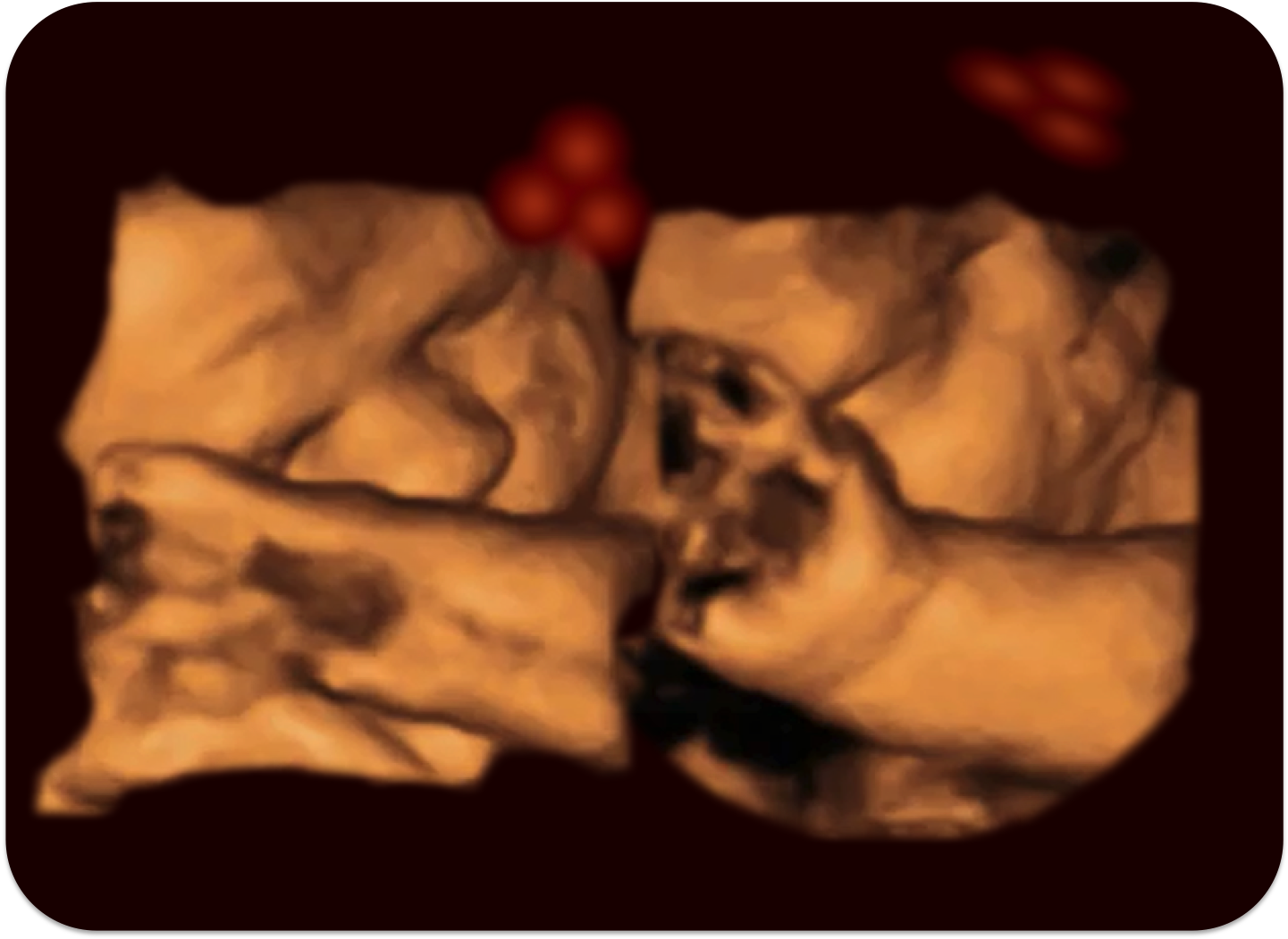 4d Fetus - Καλο Μηνα Μωρο (1579x1194), Png Download