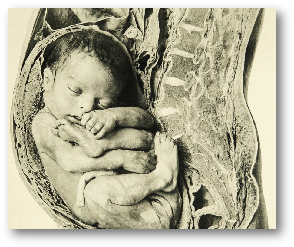 Detail, Near Full Term Fetus Placed With Anatomical - Anatomy (984x828), Png Download